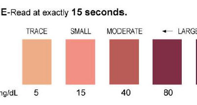 KetoDiastix Chart